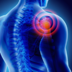 Treatments for shoulder pain